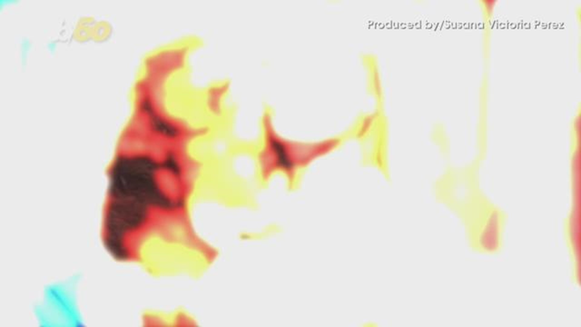 flea and tick meds seizures