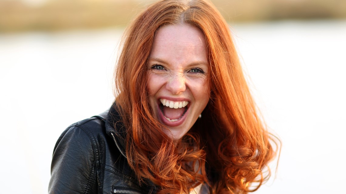 Are redheads going extinct? | 10 fun facts on World Redhead Day 