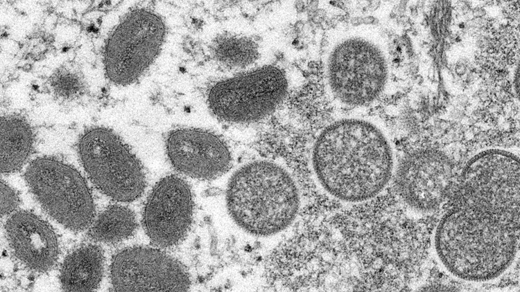 US officials announce 'aggressive' steps against monkeypox outbreak