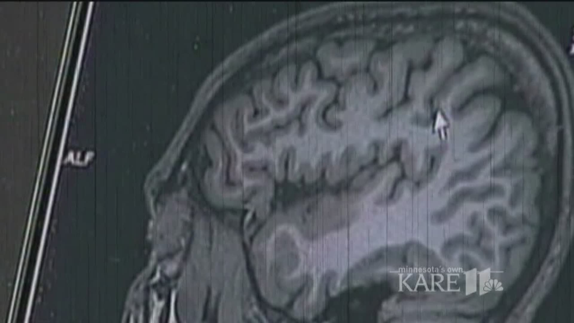 Misophonia: Kelly Ripa Has Rare Disorder Video - ABC News