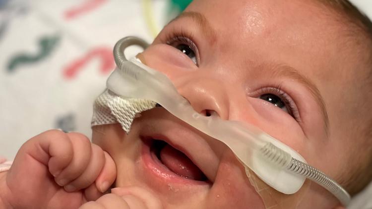 Twin girl born with 1 lung goes home after 6 months in California hospital