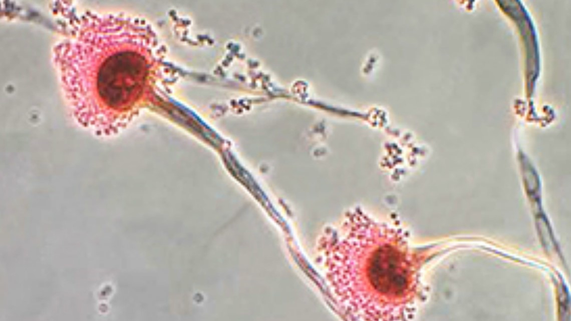Aspergillus mold What you need to know after Seattle Children's infections