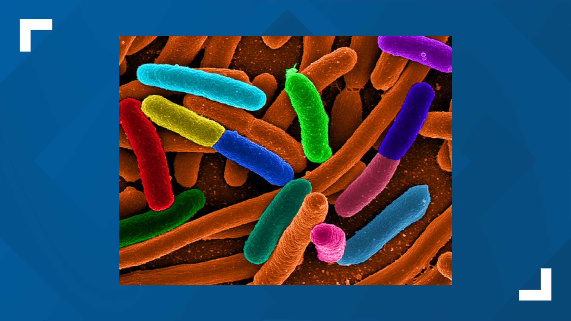 UW microbiology professor Evgeni V. Sokurenko talks about new E. coli research.