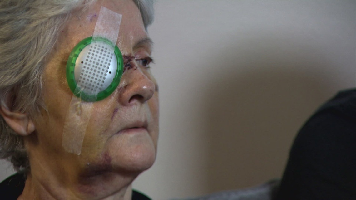 'Nobody deserves this': Seattle woman speaks out after brutal, unprovoked attack