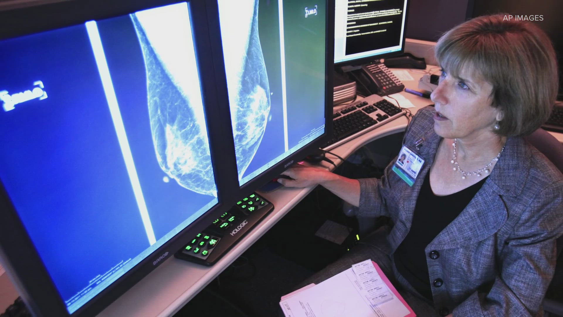 The FDA now requires a breast density report for women receiving mammograms for breast cancer screenings. The requirement is already in place in Washington.