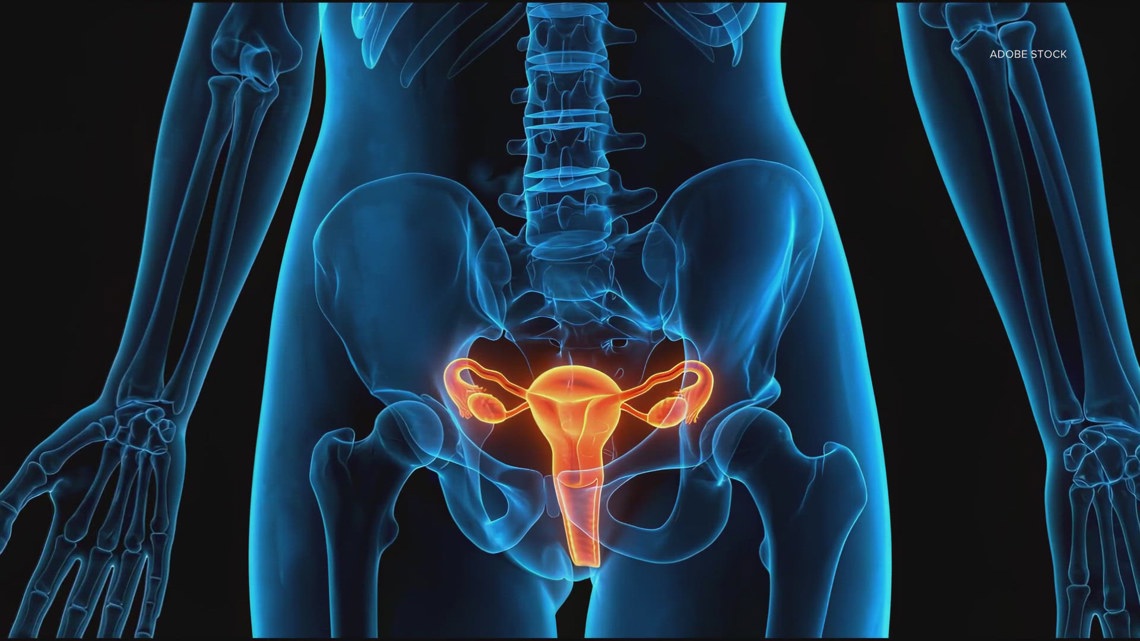 Formerly known as Polycystic Ovary Syndrome, a coalition of doctors and advocates agree to rename it to Polyendocrine...