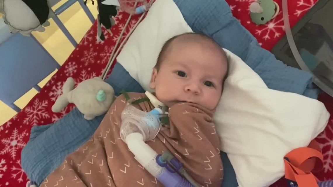 UW Medicine saves baby boy's life with rare procedure - Vimarsana News