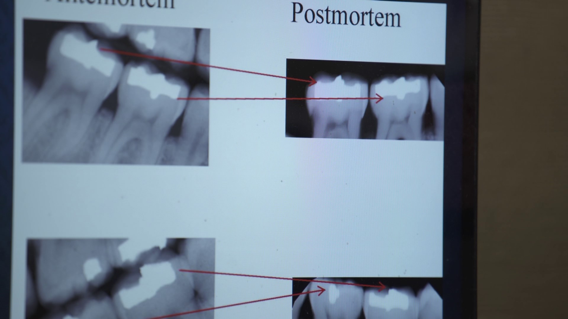 An inside look at WSP's forensic dental records system