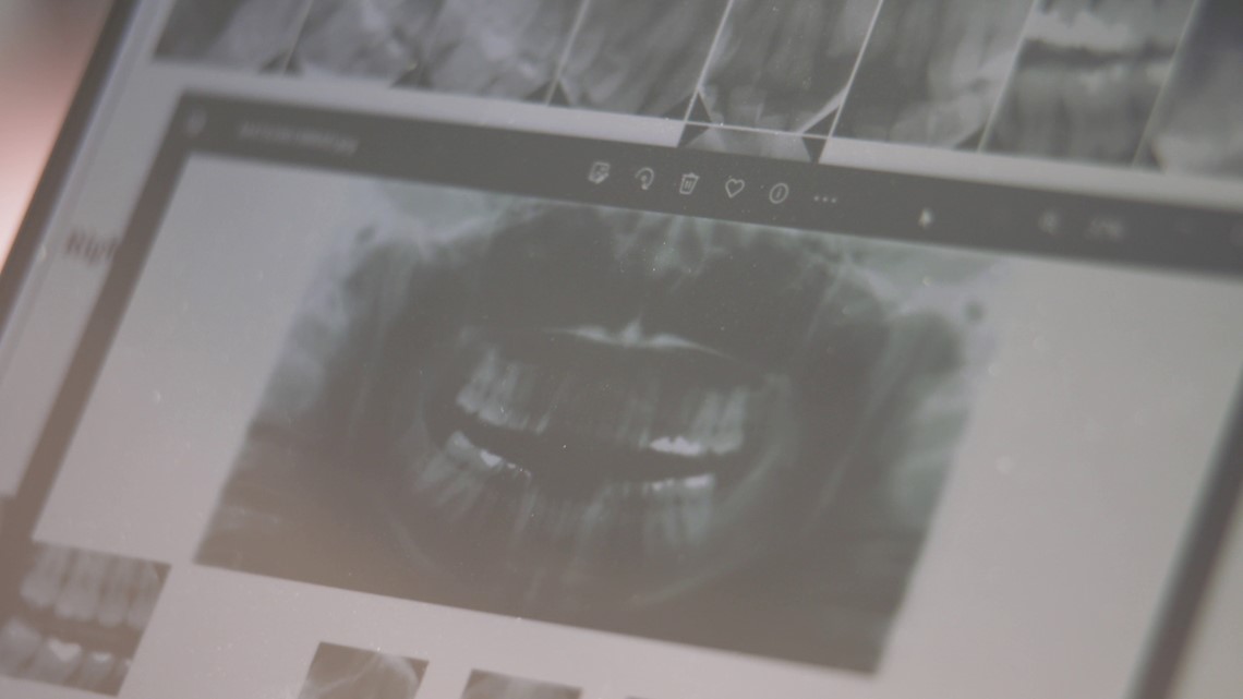 An inside look at WSP's forensic dental records system