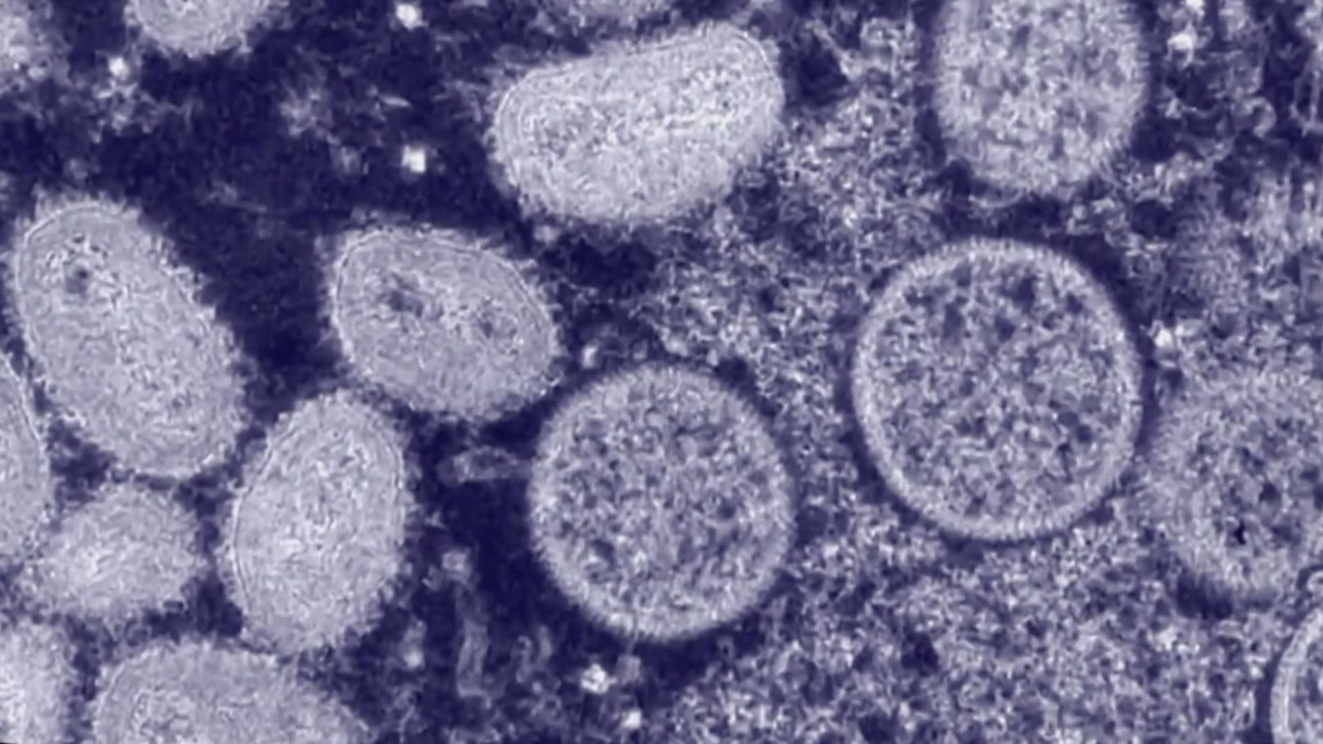 Tacoma-Pierce County health officials say the disease is not as contagious as COVID-19, mainly because it requires close physical contact to spread.