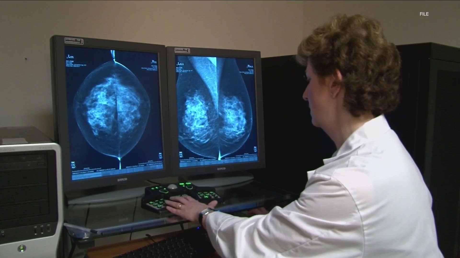 Recommended age for mammogram drops from 50 to 40; here's why. | khou.com