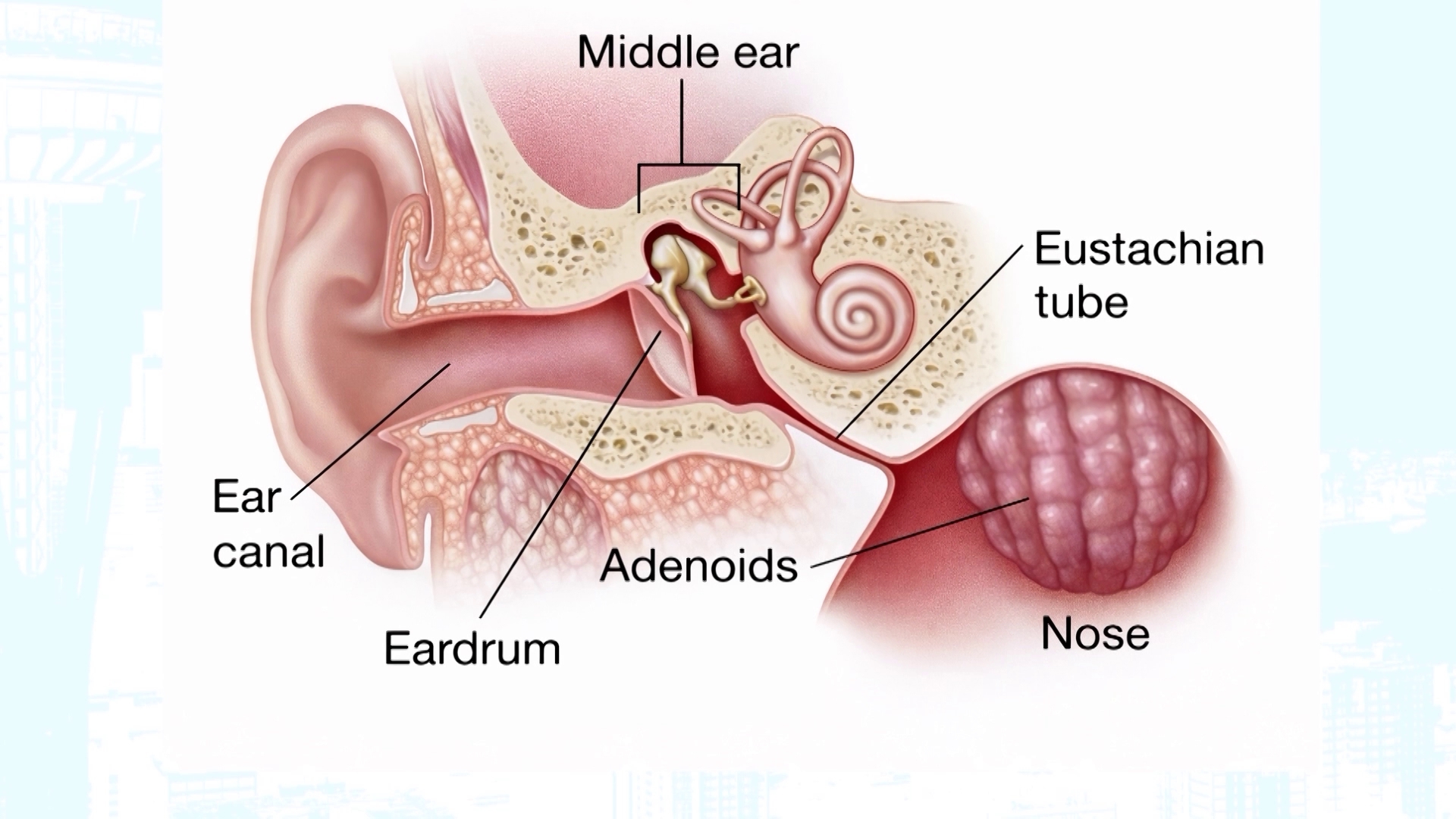 Ear infections in kids: What parents need to know - New Day NW | king5.com