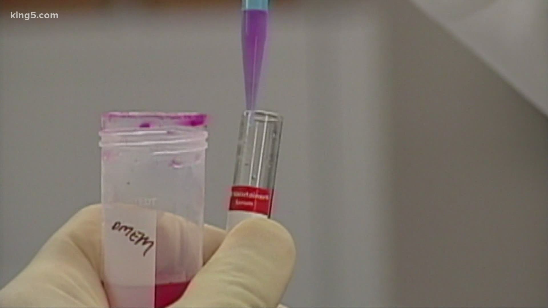 UW Medicine doctors say the state's testing should be able to detect this version of the coronavirus from the UK, which has turned up in Colorado.