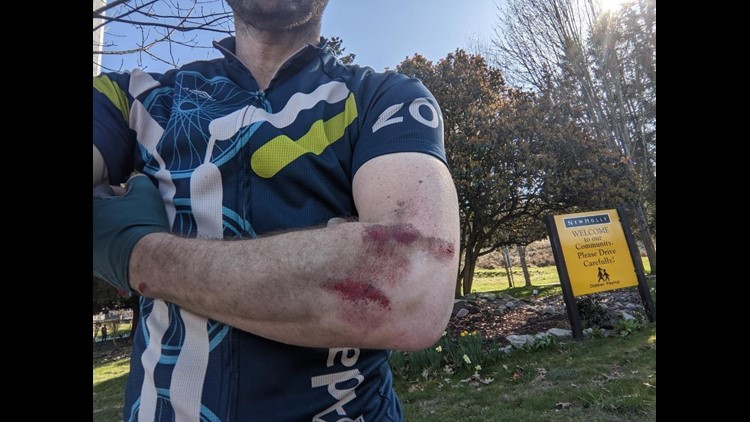 Seattle cyclist warning others after he was struck by an inattentive driver