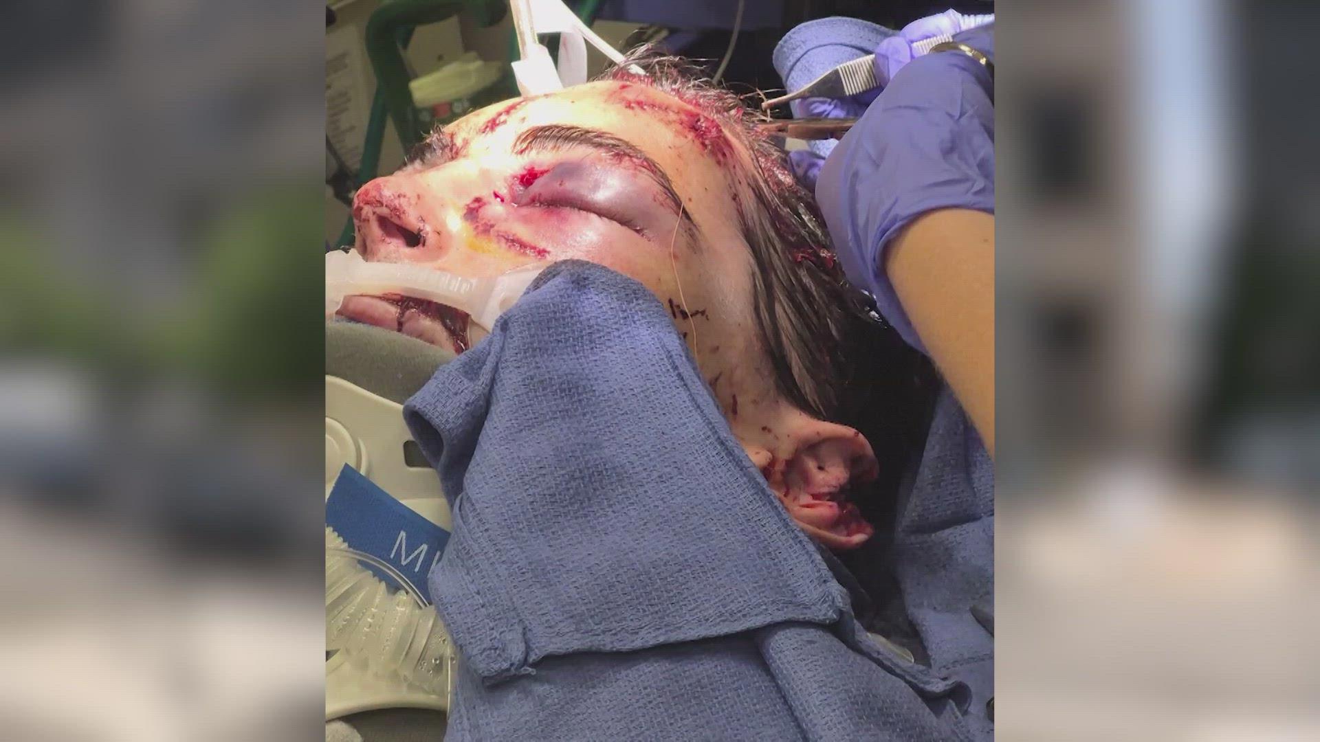 Police looking for man who attacked victim with hammer in Seattle ...
