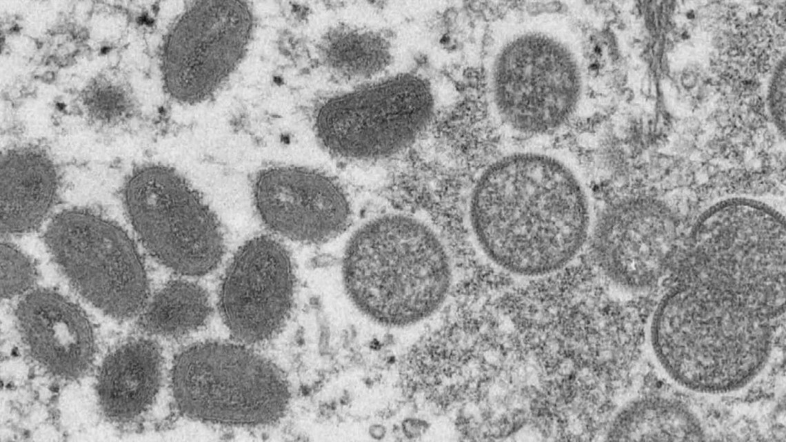 Monkeypox предотвратява разпространението на маймунската шарка, тъй като случаите във Вашингтон нарастват