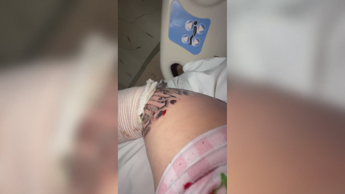 Arizona woman's tattoo lands her in hospital with severe complications