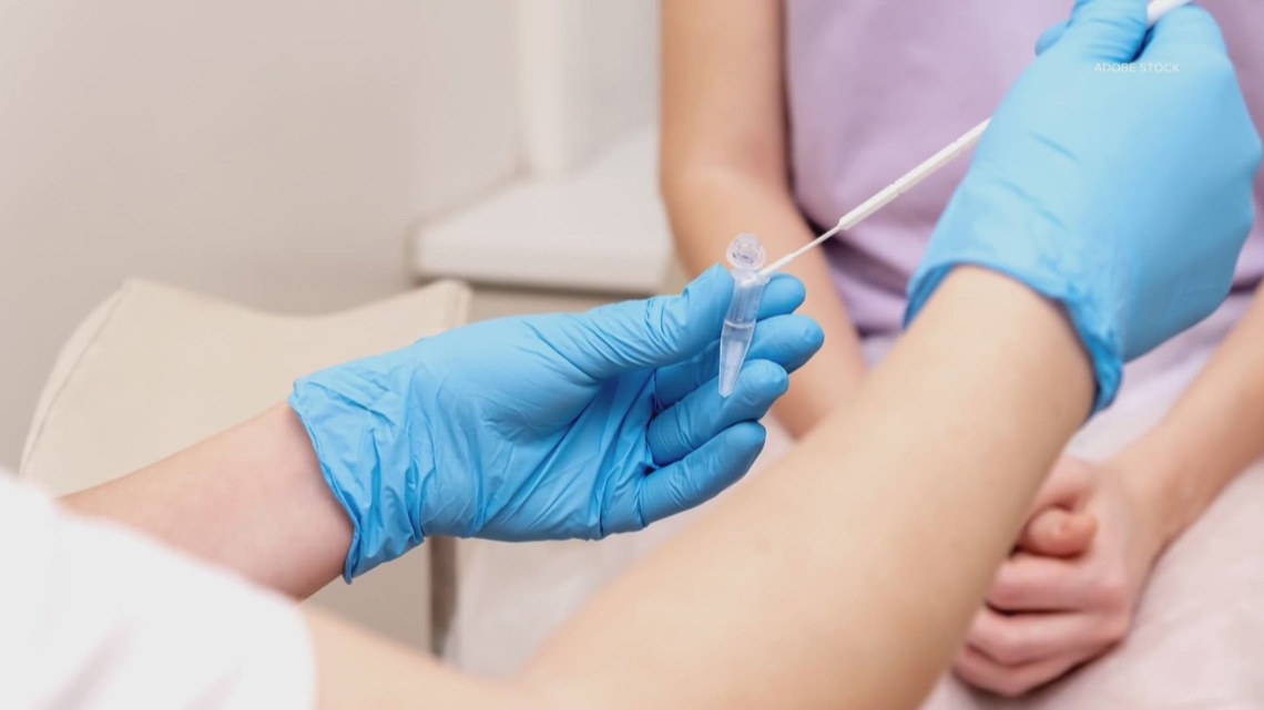 At-home HPV test now accepted in American Cancer Society's latest guideline: HealthLink