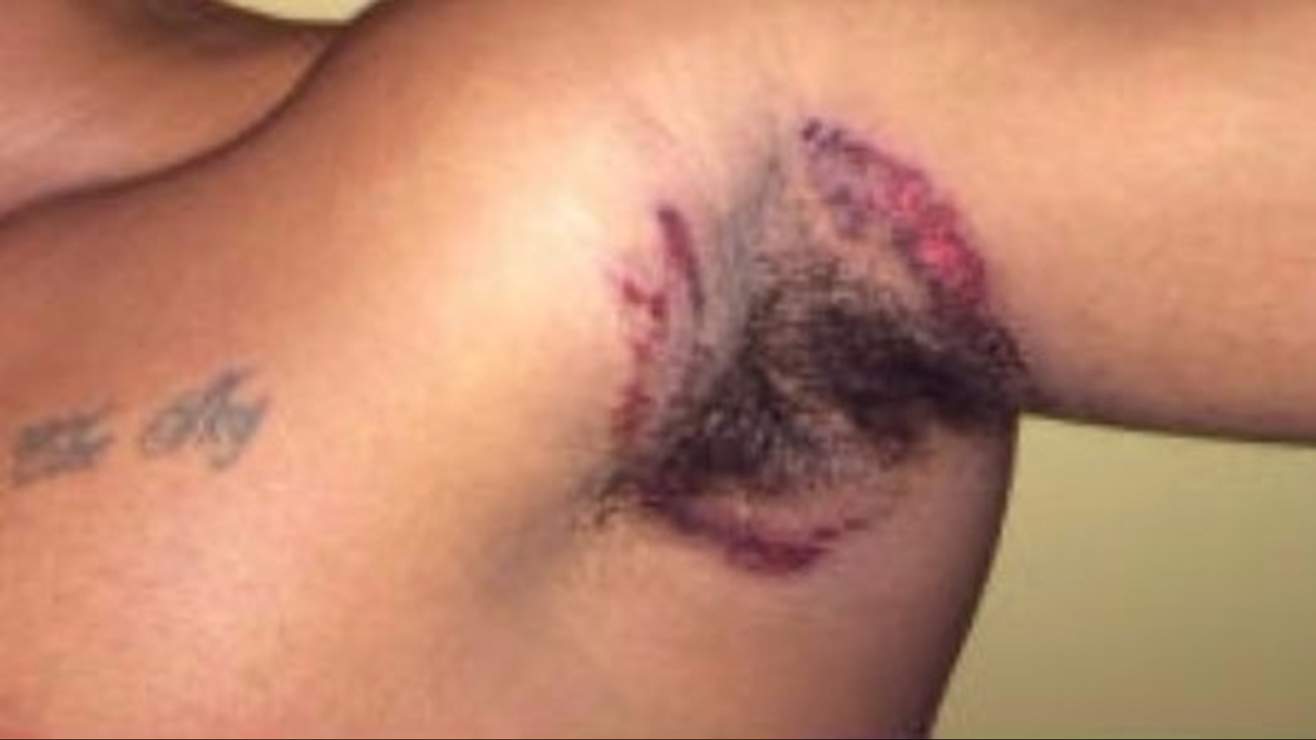 Lawsuit blames Old Spice deodorant for severe armpit rashes | king5.com
