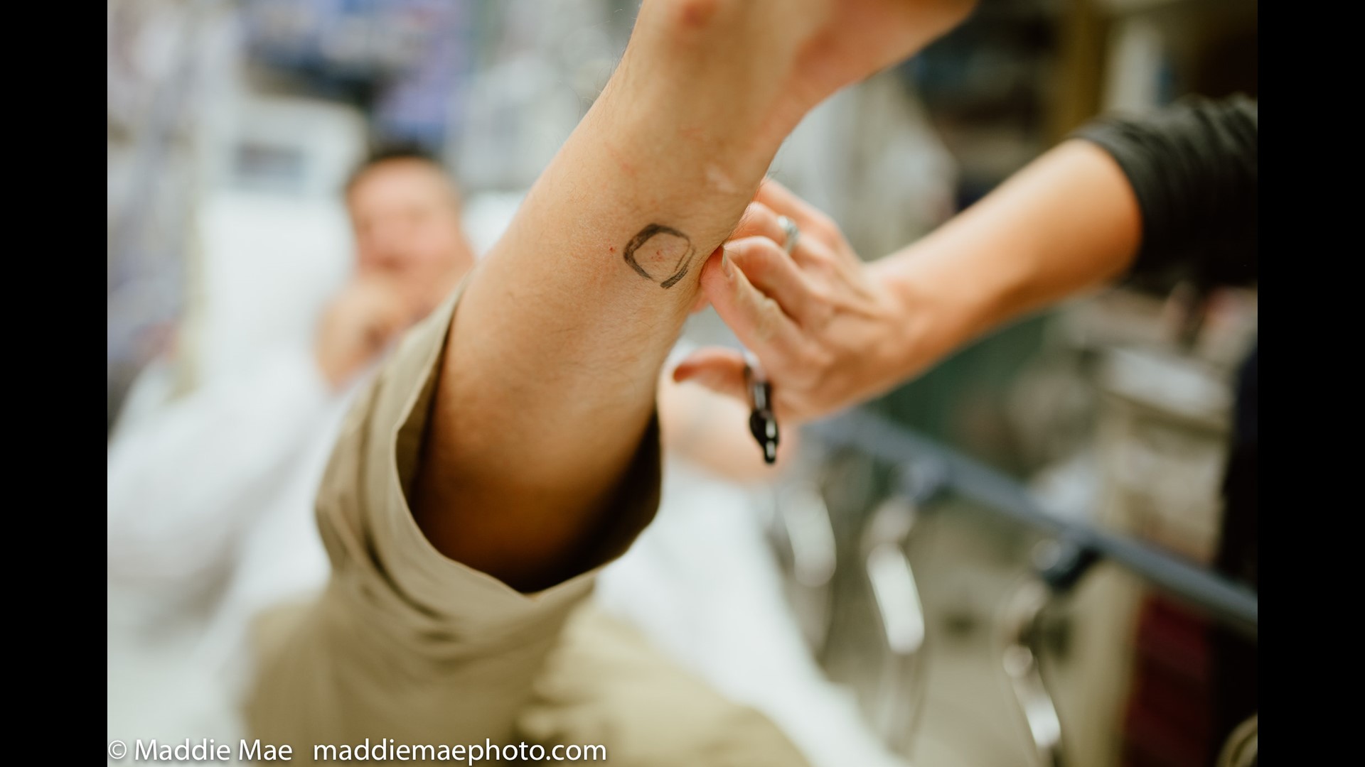Wedding photographer captures aftermath of Fort Collins groom bit by