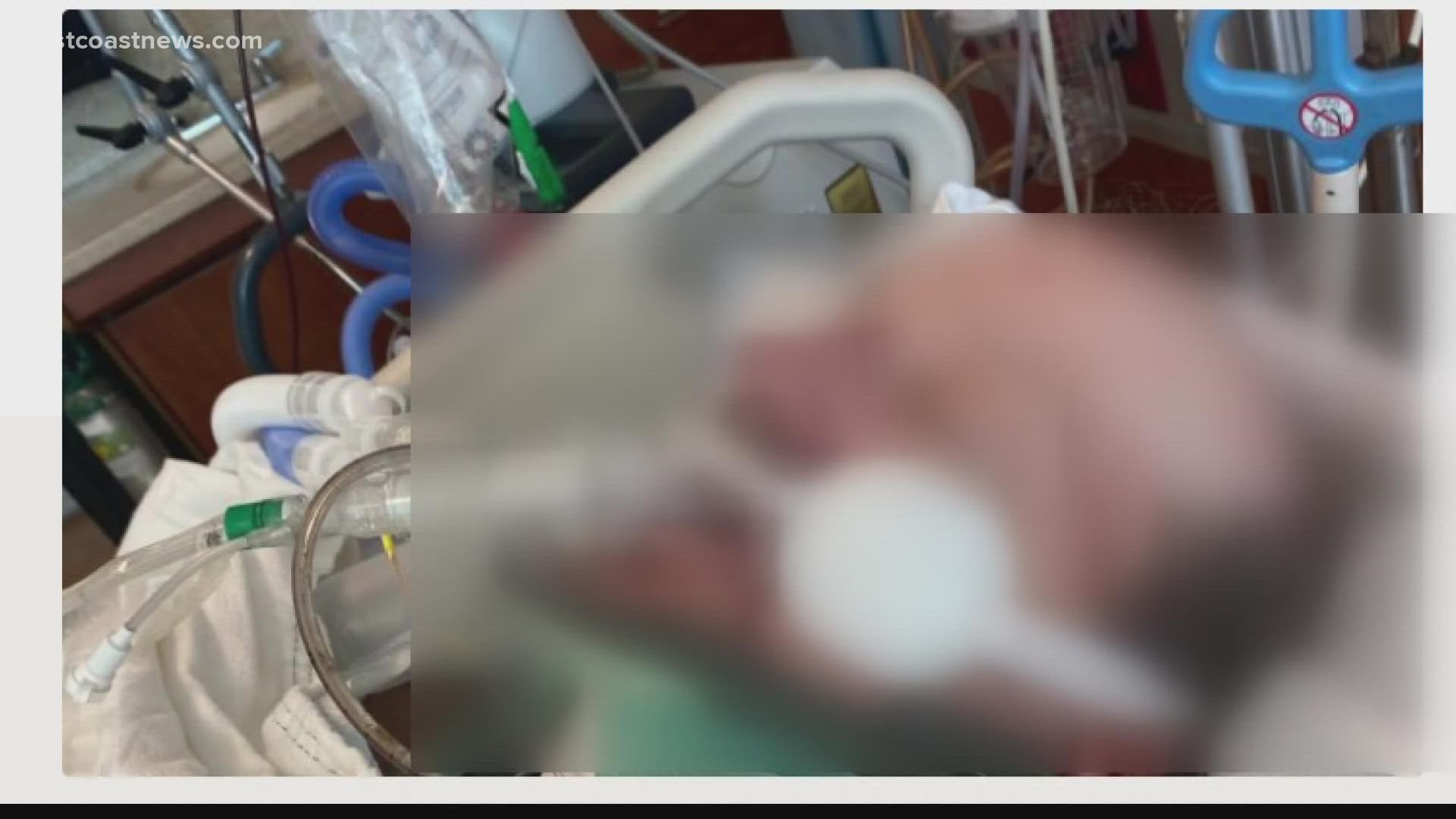 Ronnie Charles went to check on his family's horses and ended up being kicked multiple times by them before having a seizure. He was then mauled by dogs, police say.